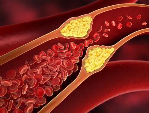 Was der Homocysteinspiegel über Ihre Gesundheit aussagt