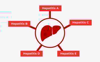 Hepatitis - Ursachen, Symptome und Behandlung von Leberentzündungen